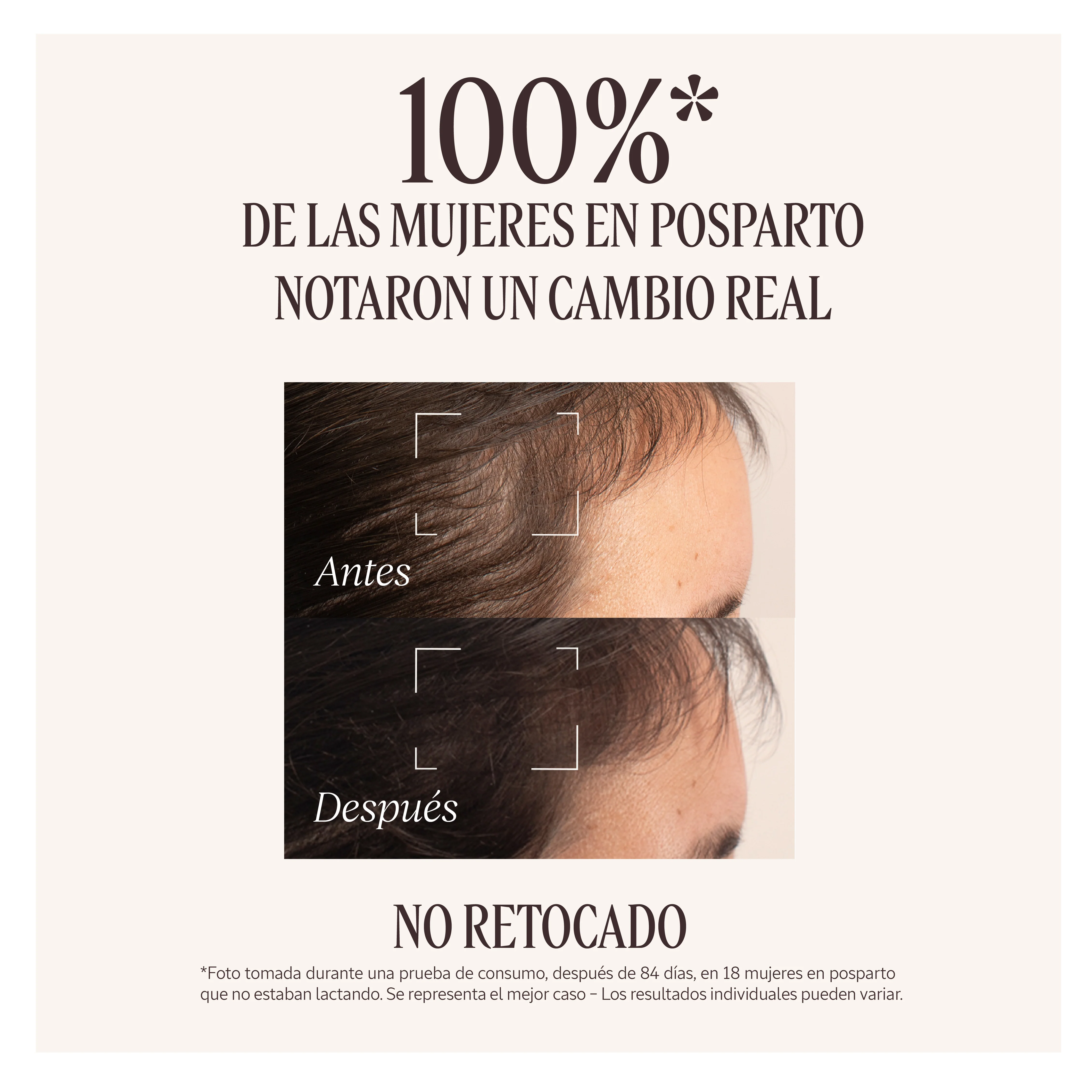 Sérum Capilar Anticaída 50ml - Image 6