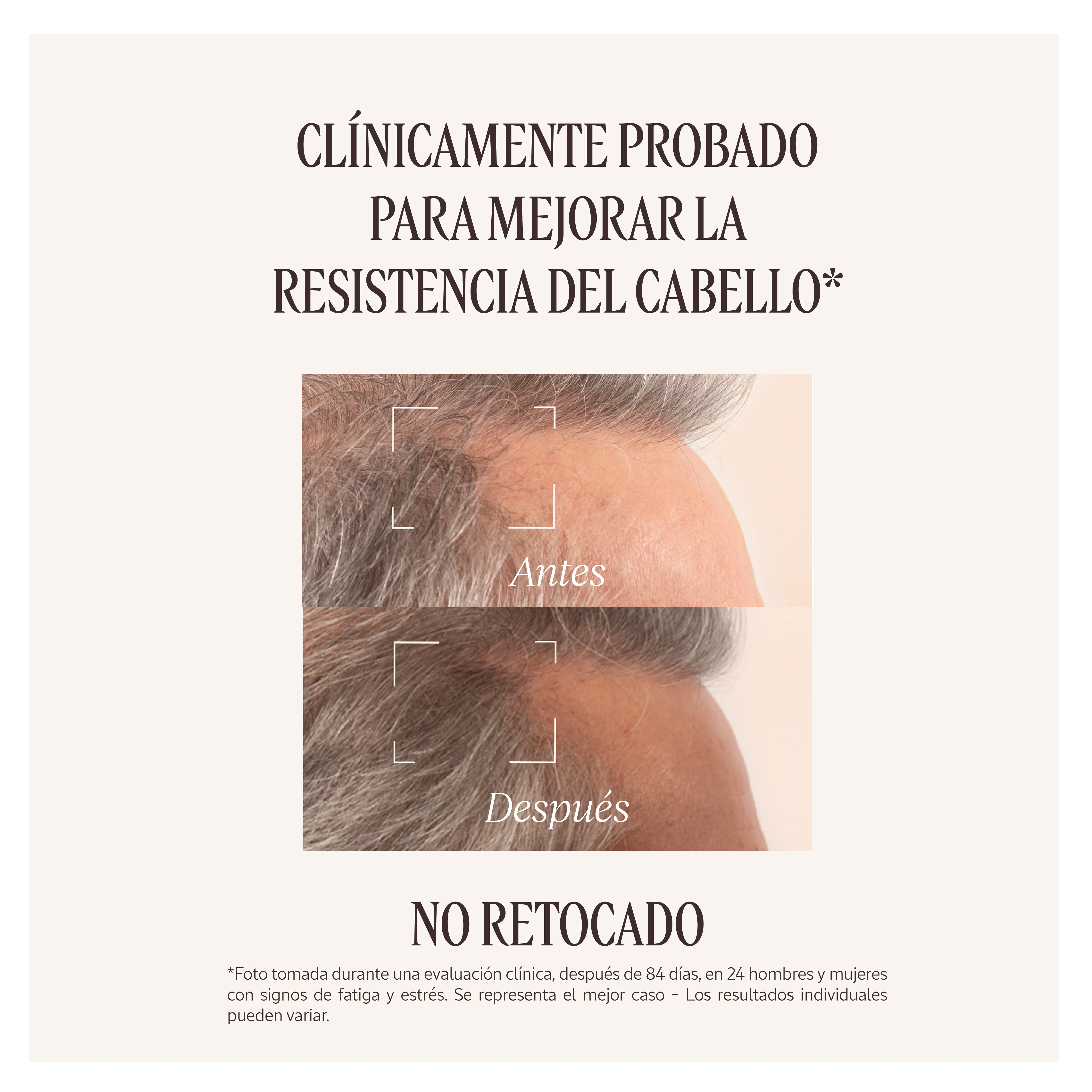 Sérum Capilar Anticaída 50ml - Image 7