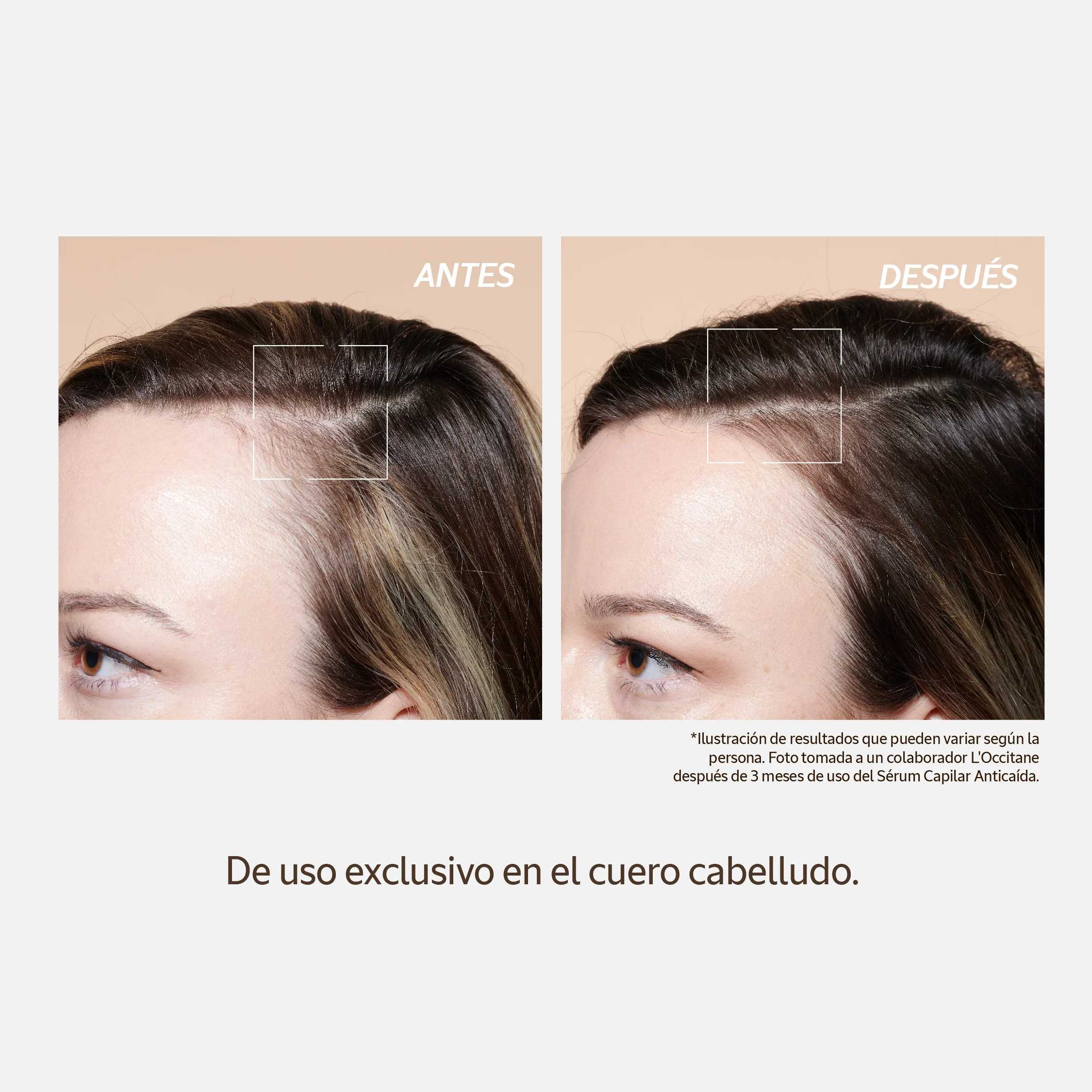 Sérum Capilar Anticaída 50ml - Image 8